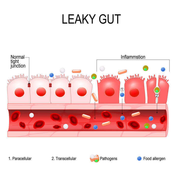 A Beginner’s Guide To A Lectin Free Diet Gundry MD