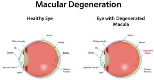 improve your vision | Gundry MD