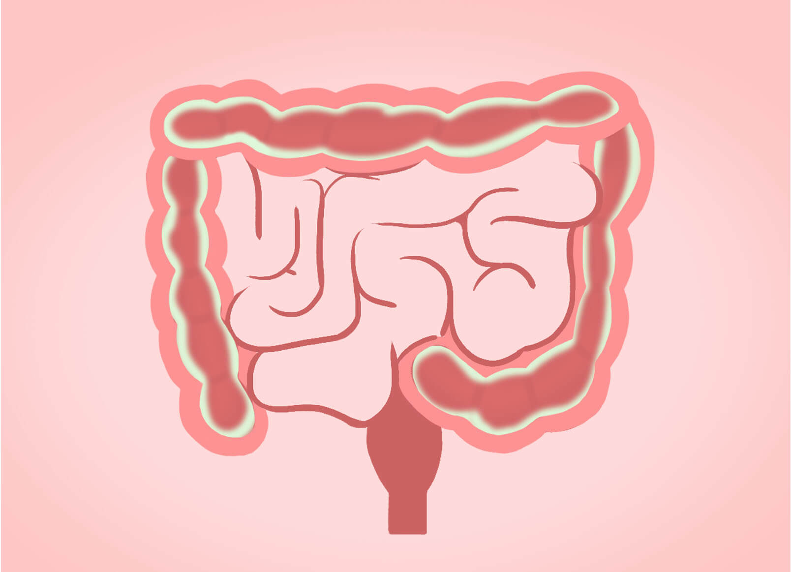 lectins | Gundry