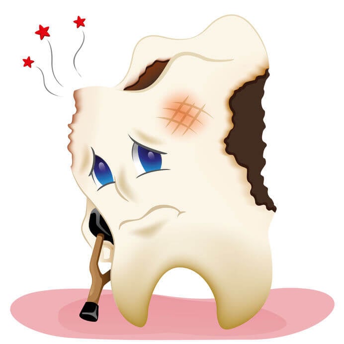 Planning on Removing Amalgam Fillings Side Effects to Note